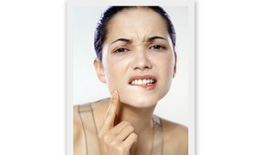 Problémy s akné? Poradíme vám, ako proti nim bojovať