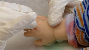 Nakazených osýpkami pribúda. Zisťovali sme, či vakcínu dostanete zadarmo aj pri neskoršom zaočkovaní