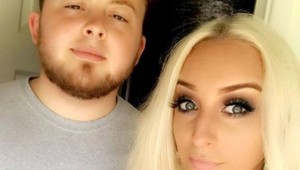 Natrela sa olejom na krajšie opálenie, vyzerá ako Quasimodo: Pozor na túto chybu!