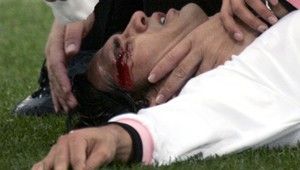 Český futbalista v nižšej súťaži skonal priamo na ihrisku