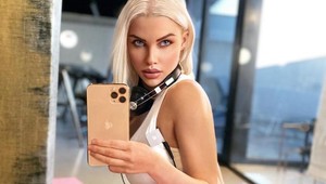 Česká Barbie ukázala, ako naozaj prebieha vylepšenie tváre: VIDEO je len pre silné žalúdky