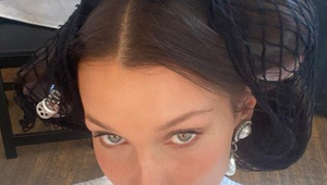 Hviezdna kráska si dala spraviť plastiku už ako 14-ročná! Teraz to ľutuje!