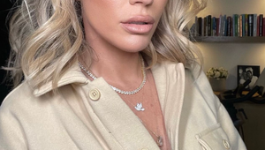 Moderátorka ukázala bolestivé jazvy po boji s rakovinou kože: Nad zákernou chorobou však stále vyhrala