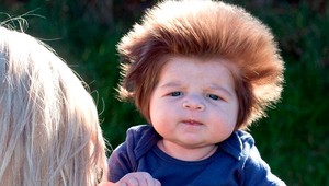 VIDEO: Chlapček má v deviatich týždňoch vlasy ako dospelák