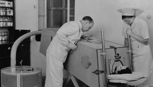 Hororovo vyzerajúci prístroj, ktorý zachraňoval životy, oslavuje 95 rokov