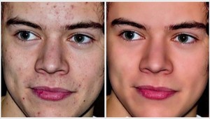 Šokujúce premeny: Fotky celebrít pred a po grafickej úprave!