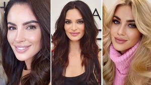 Myslíte si, že sú prirodzené? Omyl! Týmito zákrokmi prešli ich tváre!