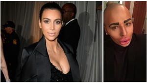 Plastikové monštrum: Muž sa nechal preoperovať na Kim Kardashian!