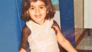 Kvôli obrovskému materskému znamienku ju volali opica: TAKTO sa s tým v dospelosti vysporiadala