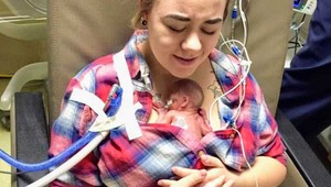 Čakala štvorčatá, prežilo iba jediné: Ako dnes vyzerá zázračné dievčatko?