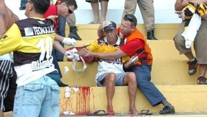 Delobuch odtrhol ruku divákovi. V okolí štadióna sa aj strieľalo