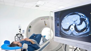 Prípad predražených CT prístrojov už vyšetruje aj NAKA