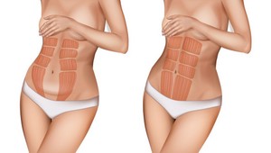 Zdravo sa stravujete, cvičíte, ale stále vás trápi vytŕčajúce bruško? TOTO môže byť dôvod!