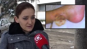 Chyba lekárov? Nešťastná Natálka (12) má dieru v nohe!