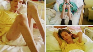 Smrť z podvýživy? Polícia preveruje ťažké obvinenia