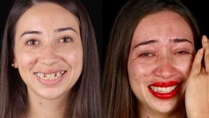 TOTO dokáže zdravý chrup: Zanedbaných ľudí zmenili nové zuby na nepoznanie