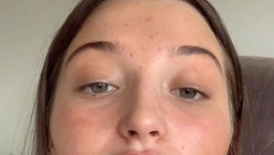 Od 16-tich bola závislá na zväčšovaní pier, stále nemá dosť: Je TOTO ešte pekné?