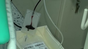 Zásoby krvných skupín na Slovensku zažívajú regres, nedostatok hlásia s negatívnym Rh faktorom