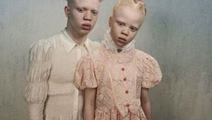 Ich výnimočný zjav uchvátil svet modelingu: Keď uvidíte ich brata, nebudete chápať