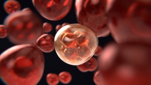 Riešenie na liečbu rakoviny? Vedci zmenili rakovinové bunky na tuk