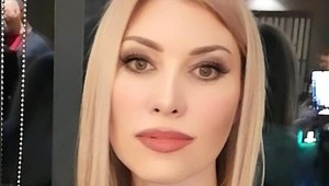 Po skrášľovacích zákrokoch zostala znetvorená: Kráľovná krásy sa nedokáže usmiať ani zavrieť oči