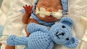 Nemalo ani 500 gramov a lekári mu nedávali žiadnu šancu: Ako vyzerá predčasniatko dnes?