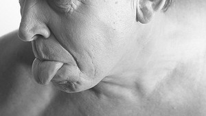 Nová analýza krvi môže predpovedať demenciu 10 rokov vopred