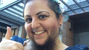 Bradatá žena neverila, že si nájde lásku: ON sa do nej zamiloval na prvý pohľad