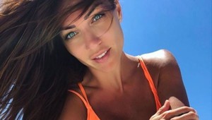 Šokujúce foto PRED a PO zákroku: Orviskej tmavé kruhy pod očami sú preč