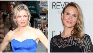 Renée Zellweger (45) to prehnala s plastikami, je z nej iná žena!