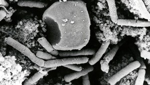 Viac ako sedemdesiat vedcov sa malo nakaziť antraxom