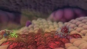 Transplantácia kostnej drene. Slovákov zachránili Nemci