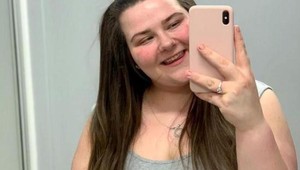 Žena, ktorá zhodila takmer 90 kíl, ukázala realitu: Takto budete vyzerať po extrémnom schudnutí