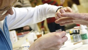 Za odbery platiť zrejme nebudeme, Všeobecná zdravotná poisťovňa rokuje s firmou Medirex