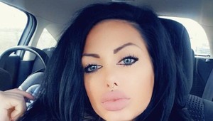 Jej OBROVSKÉ pery sú už minulosťou: Simonka priznala zákrok, ktorý ju zmenil