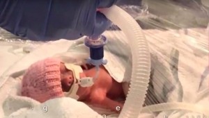 Narodila sa menšia ako iPad: Pozrite sa, ako vyzerá malá bojovníčka po 5 mesiacoch