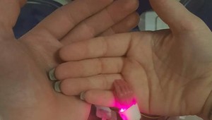 Jej dlaň mala veľkosť centov, keď sa narodila: Čo sa stalo s najmenším bábätkom Británie?