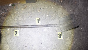 Traja útočníci napadli muža lopatou. Muž útok neprežil