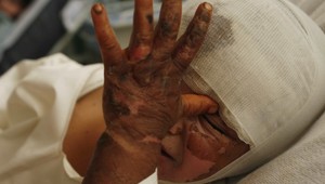 V Tatrách zachraňovali Čecha