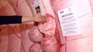 Počet prípadov rakoviny hrubého čreva rastie,: Týchto 10 príznakov berte vážne!