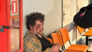 Ír zlomil zdravotníkovi v Bratislave nos. "Okradli ma," bránil sa v rozhovore