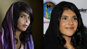 Fotka roka! Je na nej zohavená afgánska žena