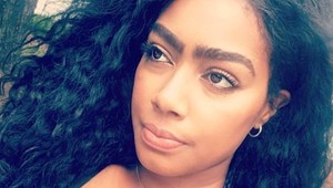 Prestala sa trápiť, že je iná: Žena dnes hrdo ukazuje, za čo sa jej smiali celé detstvo