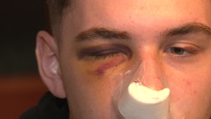 Hokejista mal údajne napadnúť 19-ročného mladíka, ten skončil v nemocnici