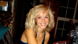 Zázrak! Modelku obliali kyselinou, vďaka zákrokom jej lekári navrátili krásnu tvár!