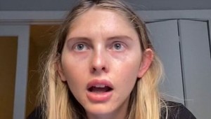 Anna je z podmienok na kastingu úplne hotová: Vraj som na modeling príliš tučná!