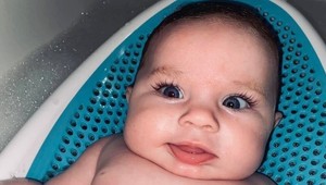 Keď jej po pôrode ukázali dcérku, myslela si, že ju vymenili: Pozrite sa, čo jej narástlo na hlave!