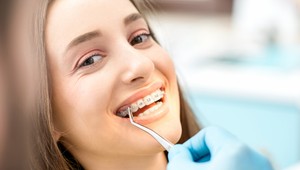 Union bude prispievať na zubné strojčeky