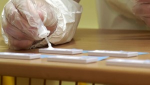 Máte v rodine Lynchov syndróm? Zapojte sa do dôležitej štúdie!