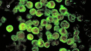 Chlapec (†12) sa kúpal v jazere. Zomrel na následky améby "požierajúcej mozog"